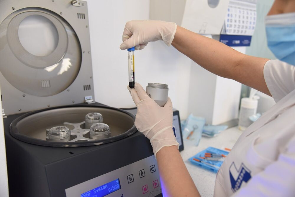Aparat de centrifugă pentru injectarea plasmei - tehnologie Endoret pentru tratamentul parodontozei la Clinica de Stomatologie SANADOR.